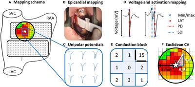 In-vivo Sino-Atrial Node Mapping in Children and Adults With Congenital Heart Disease